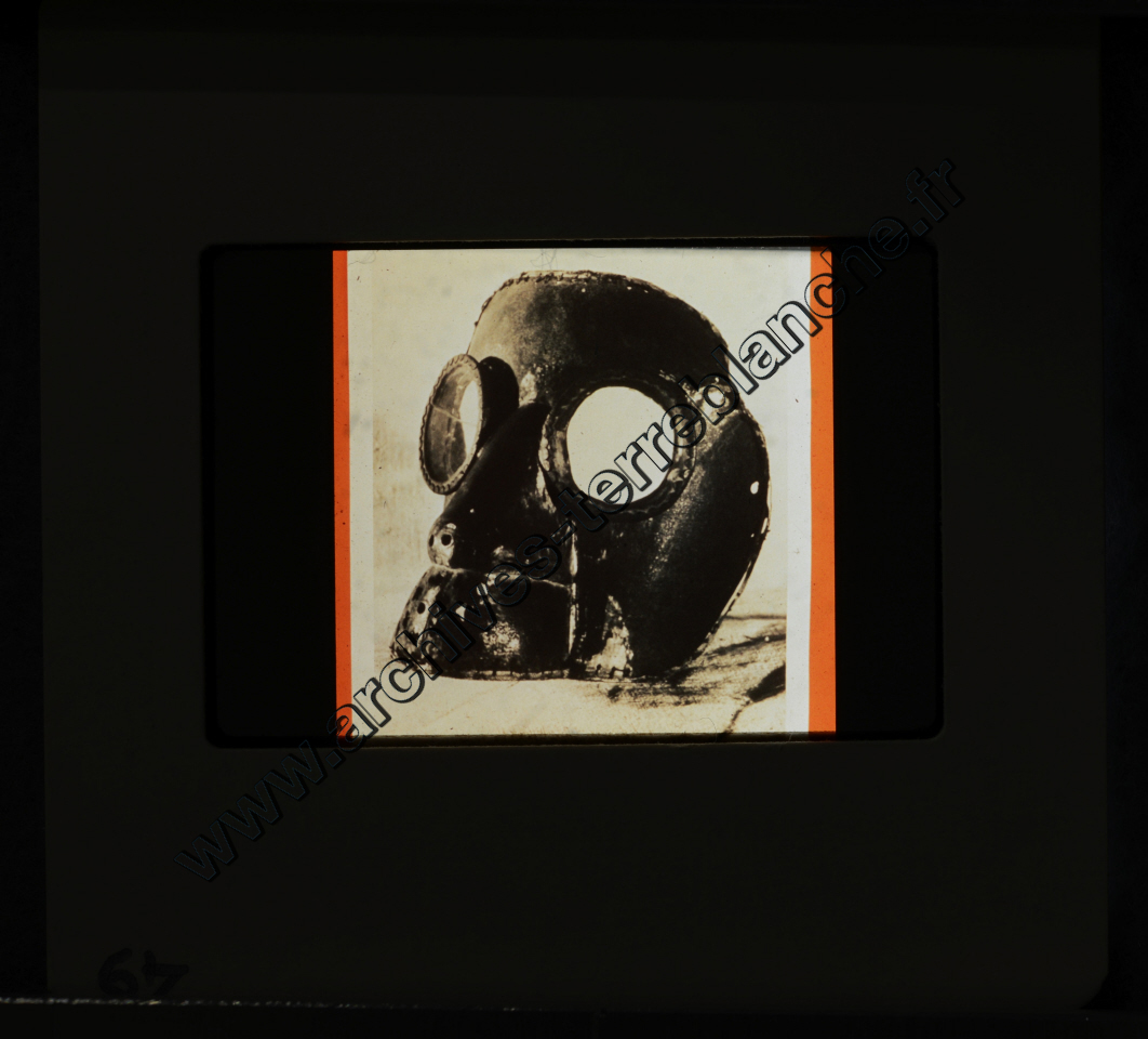 La Protection de la vue