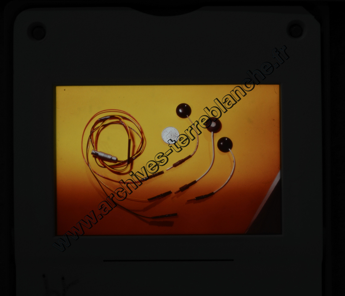 Fréquence Cardiac (partie 2)