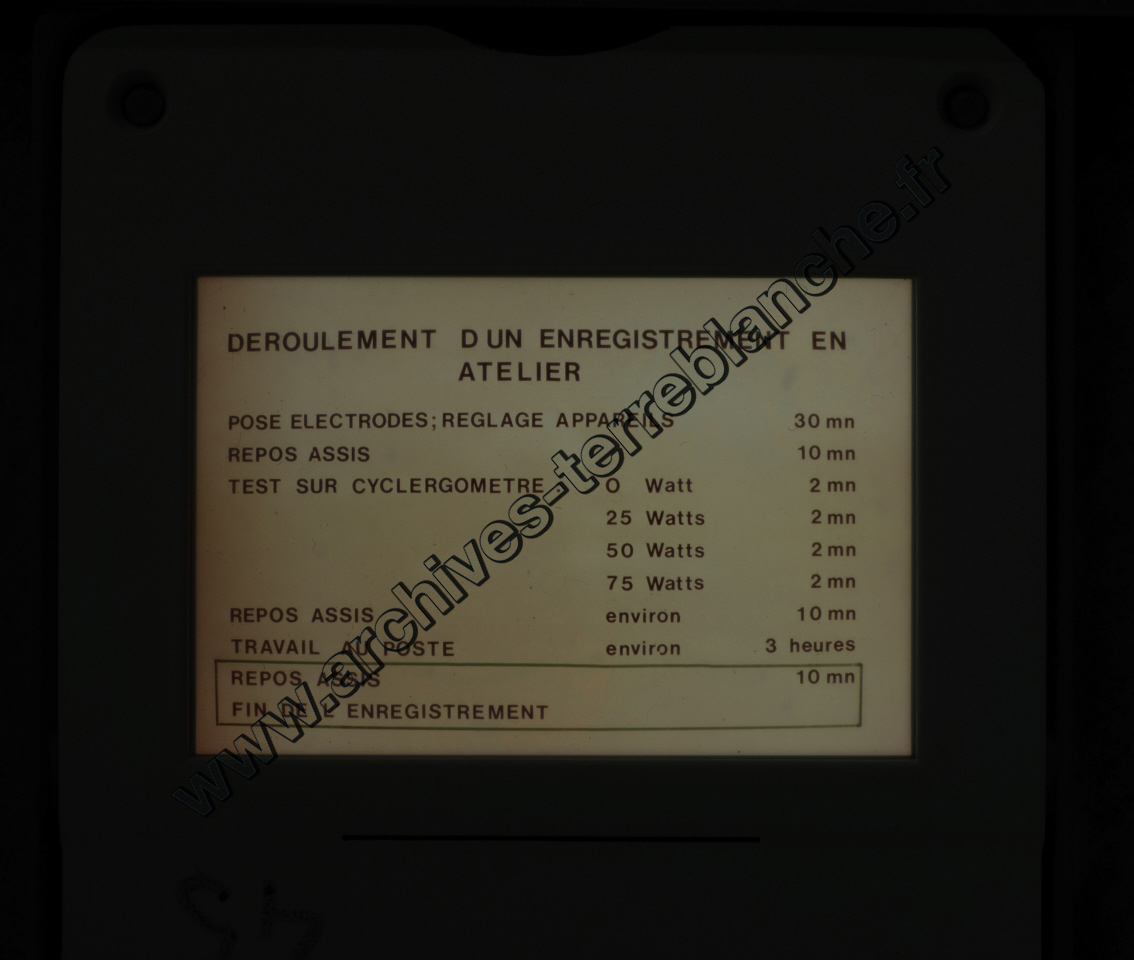 Fréquence Cardiac (partie 2)