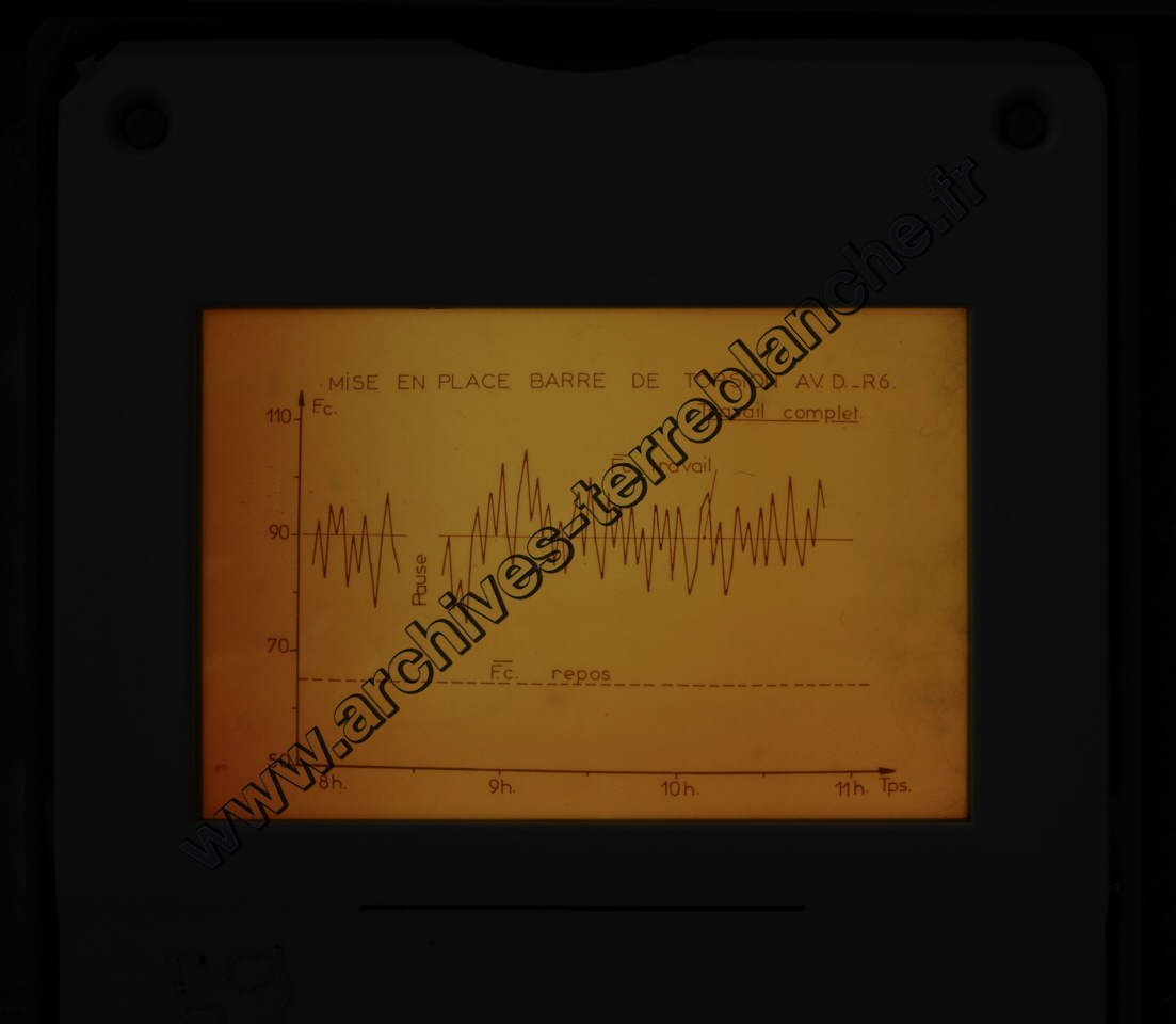 Fréquence Cardiac (partie 2)