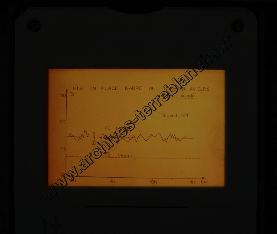 Fréquence Cardiac (partie 2)