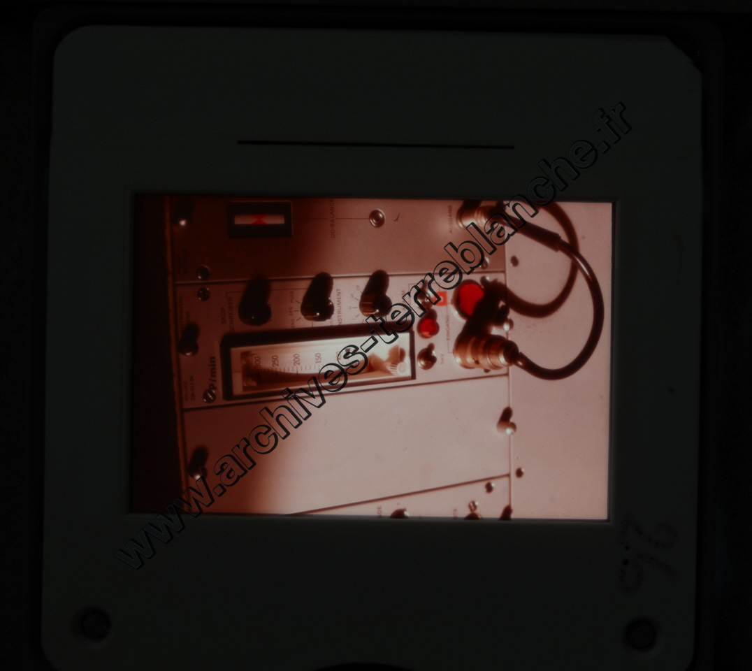 Fréquence Cardiac (partie 1)