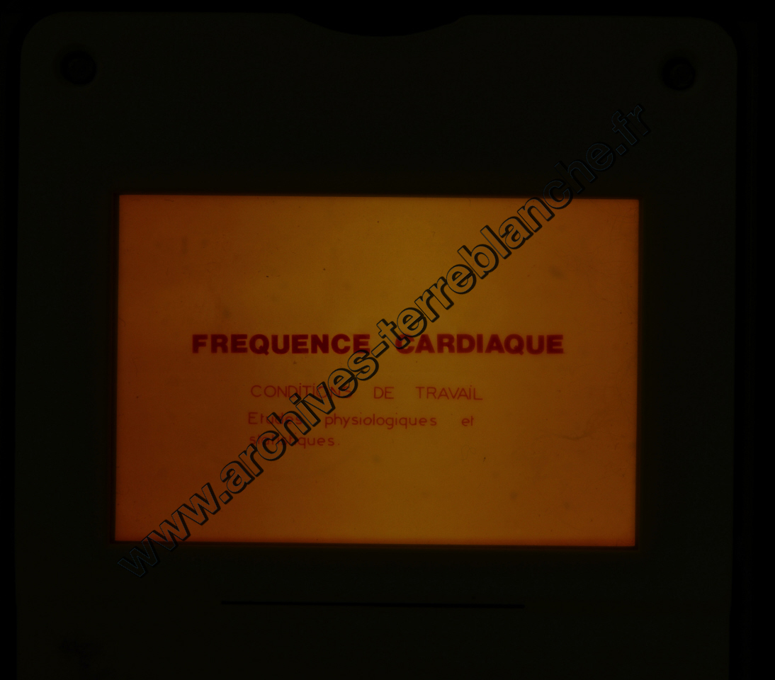 Fréquence Cardiac (partie 2)