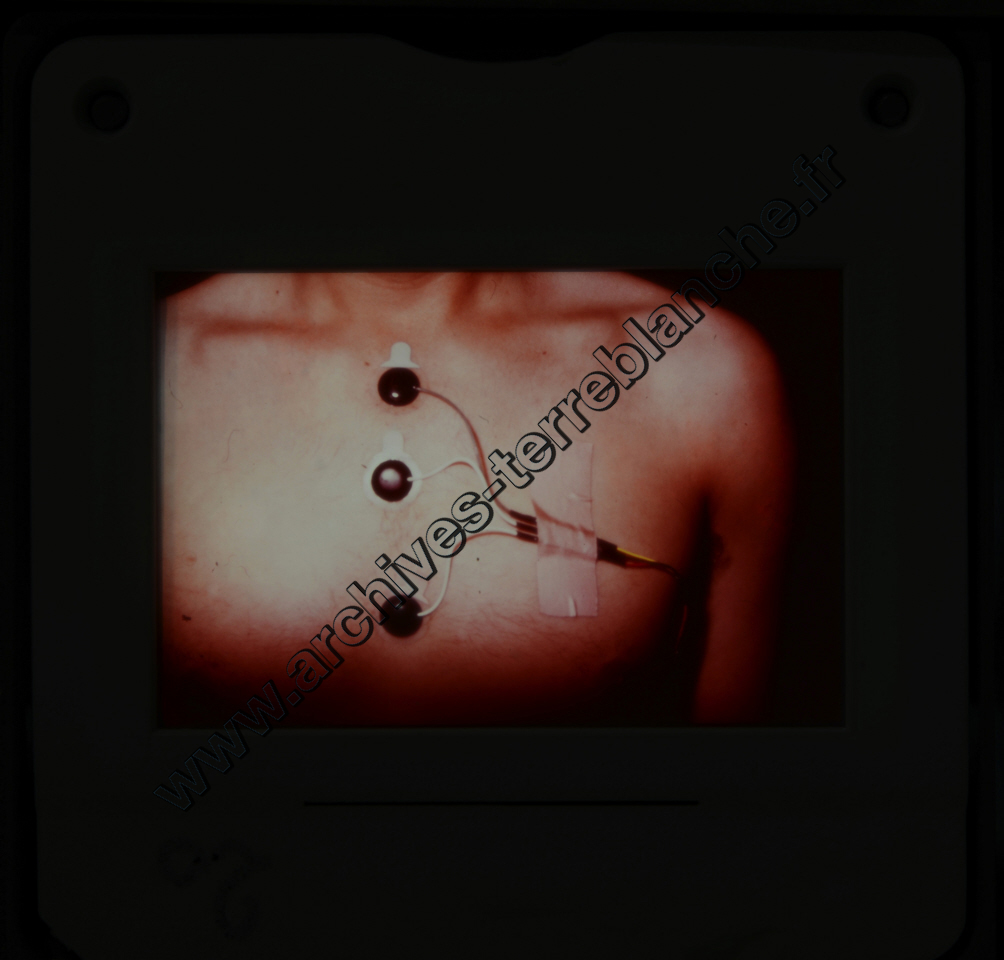 Fréquence Cardiac (partie 1)