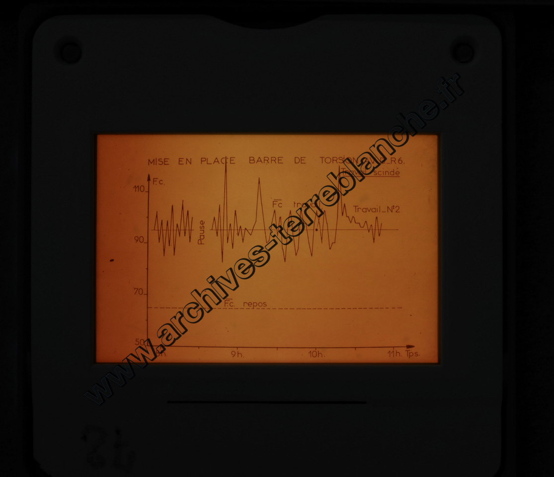 Fréquence Cardiac (partie 1)