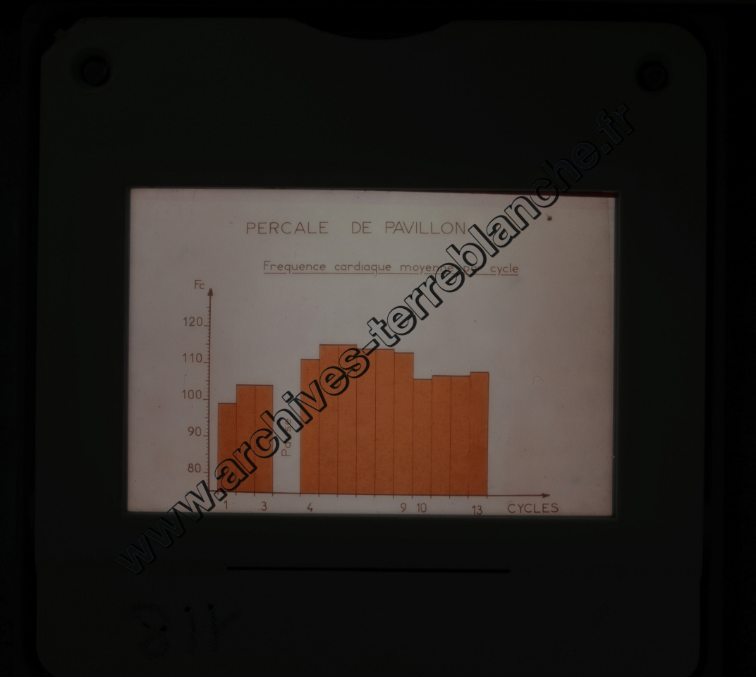 Fréquence Cardiac (partie 1)