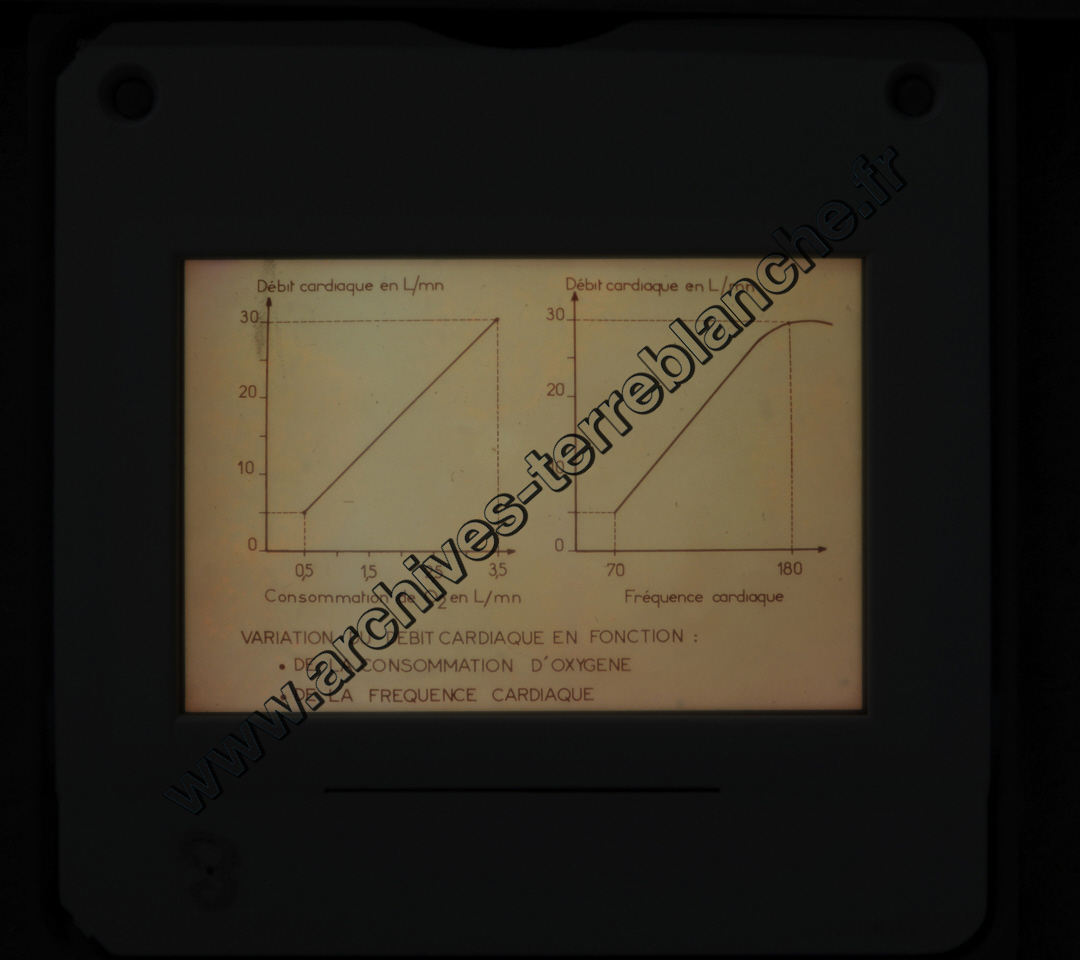 Fréquence Cardiac (partie 1)