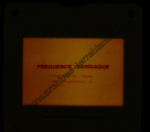 Fréquence Cardiac (partie 2)