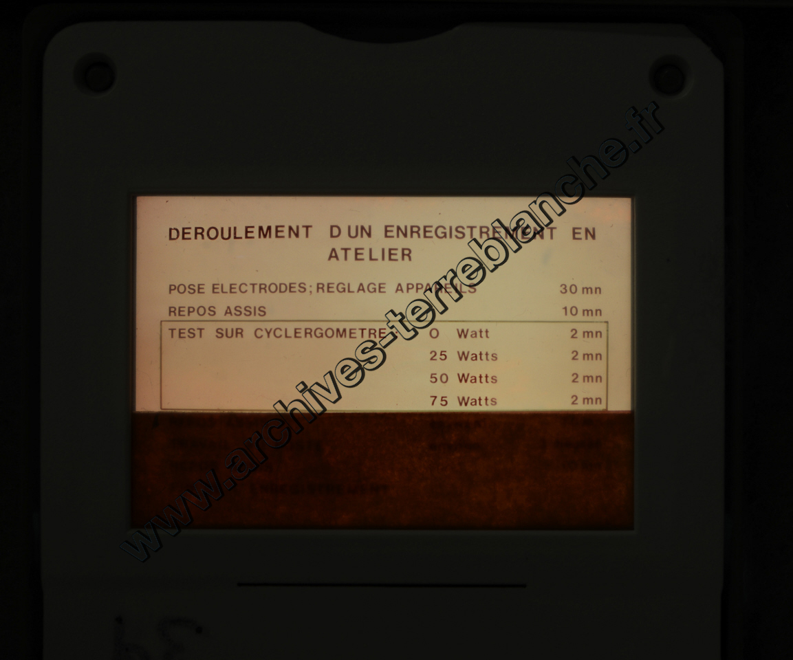 Fréquence Cardiac (partie 2)